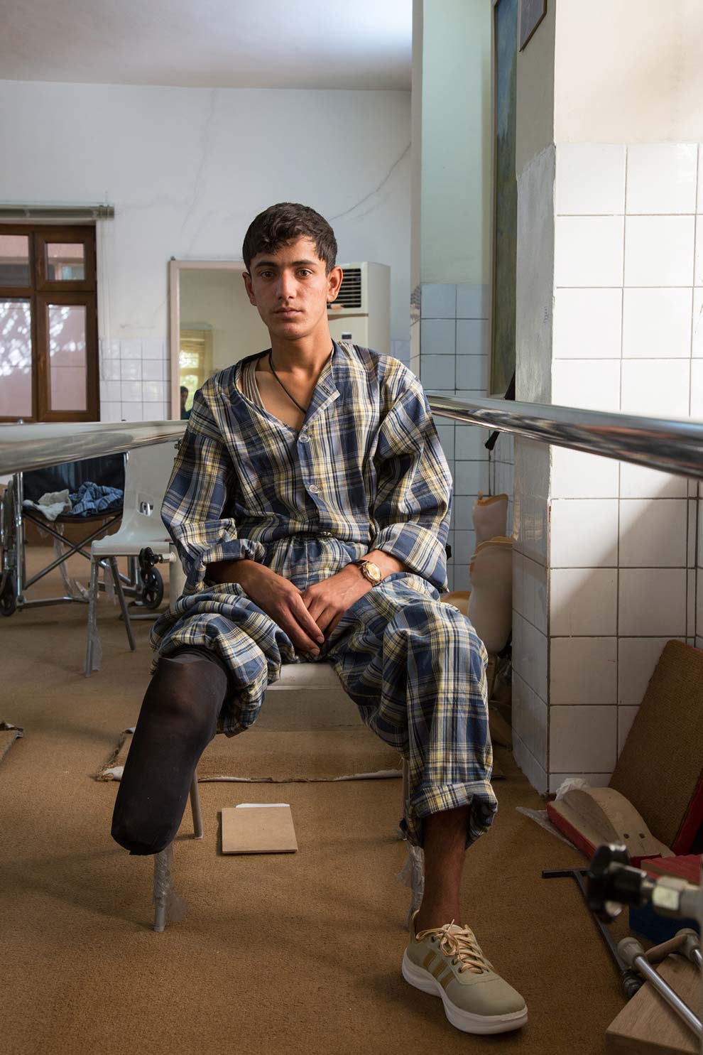 Un ragazzo senza una gamba, vittima di guerra